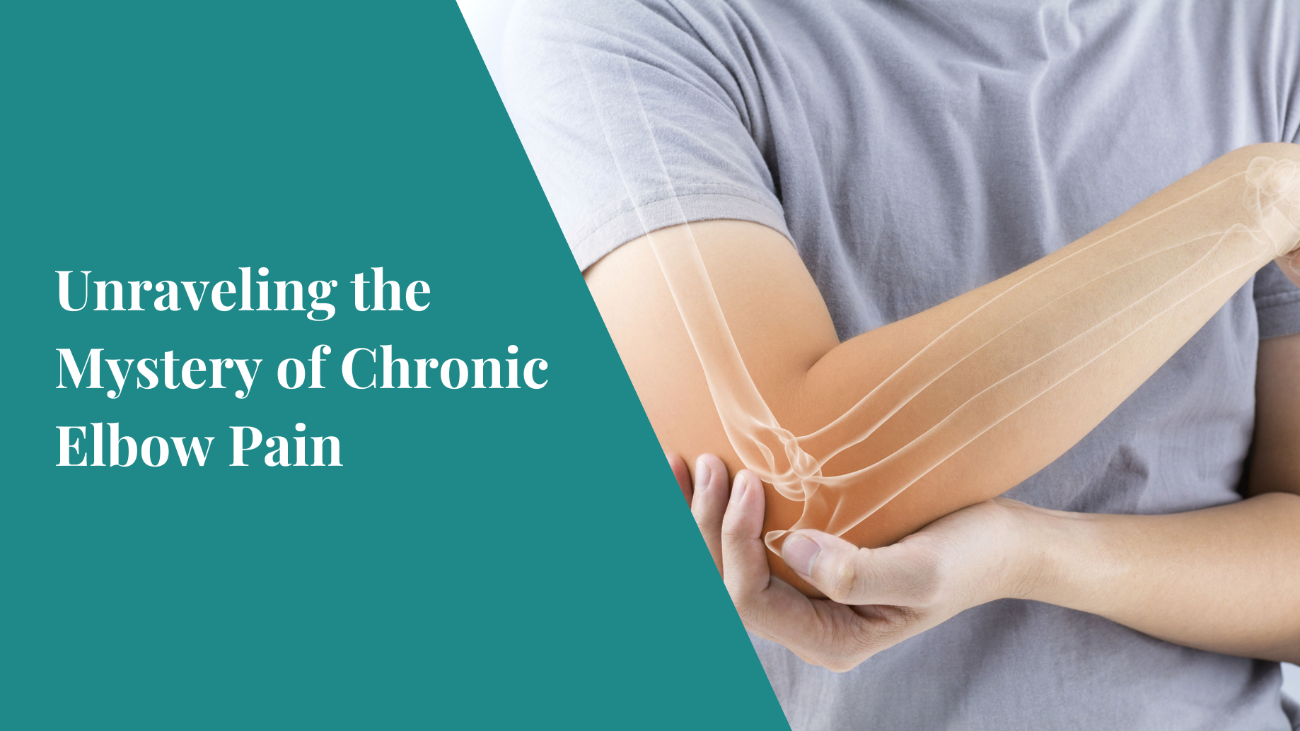 Unraveling the Mystery of Chronic Elbow Pain